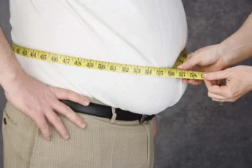 Obesity-body-fat-accumulation-conditions
