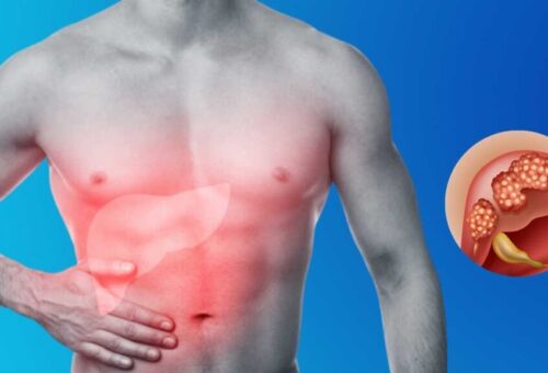 how-serious-is-a-tumor-in-the-liver