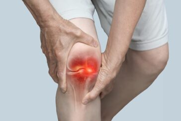 Hand,Holding,Knee,With,Pain,Due,To,Degenerative,Arthritis